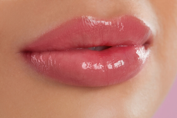 Preenchimento Labial em Passo Fundo - Dra. Carla Furlanetto